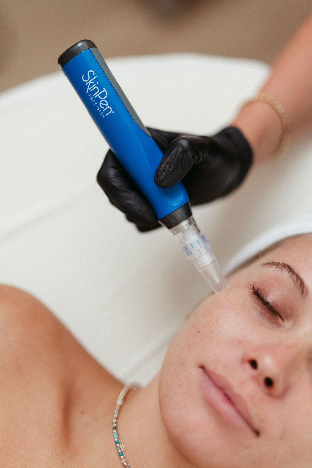 SkinPen Microneedling